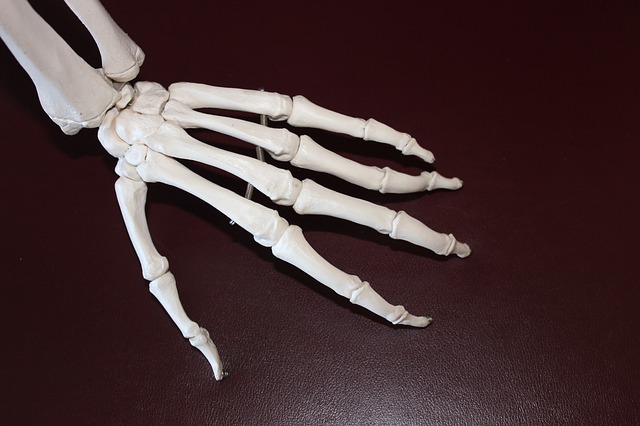arthritis, arthritis in hands